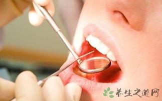 吃瓜牙疼厌氧菌,厌氧菌滋生引发吃瓜牙疼之谜探究  第3张